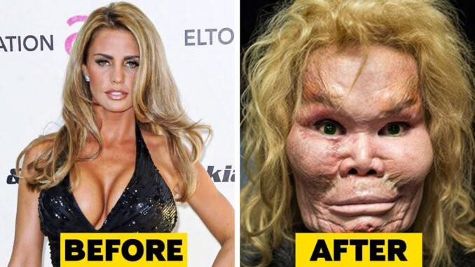 Model Removes Fillers After Near-Death Ordeal