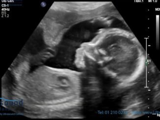 Woman alters pregnancy scan date