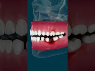 Man dies after botched Turkey dental job