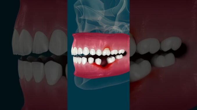 Man dies after botched Turkey dental job