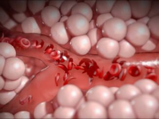 Woman Shares Sickle Cell Healing Story