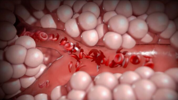 Woman Shares Sickle Cell Healing Story