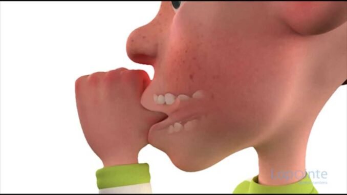 Thumb-sucking habit in adulthood
