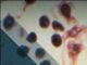 WHO declares cruise ship hantavirus over